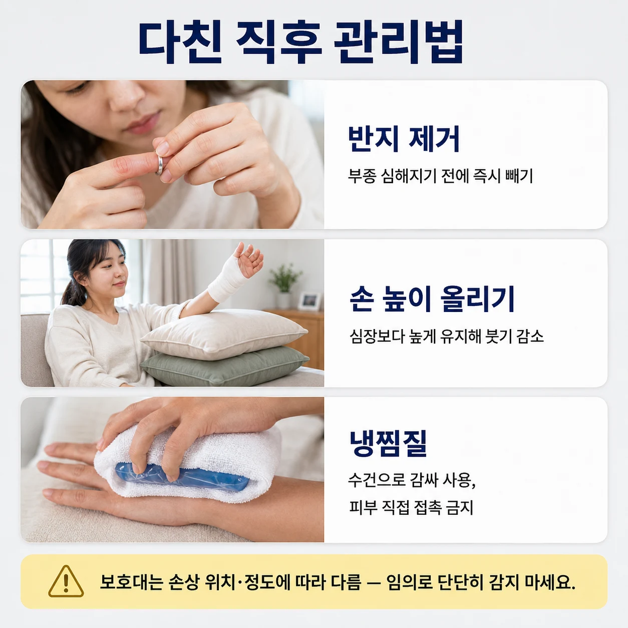 반지 제거, 손 높이 올리기와 수건으로 감싼 냉찜질
